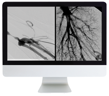 Clinical Vascular and Interventional Radiology Review Online Course