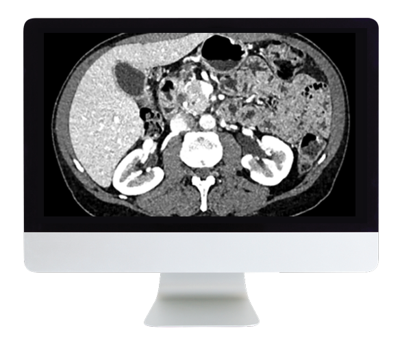 Gastrointestinal Imaging Online Course