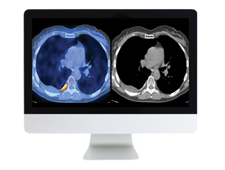 PETCT Online Course