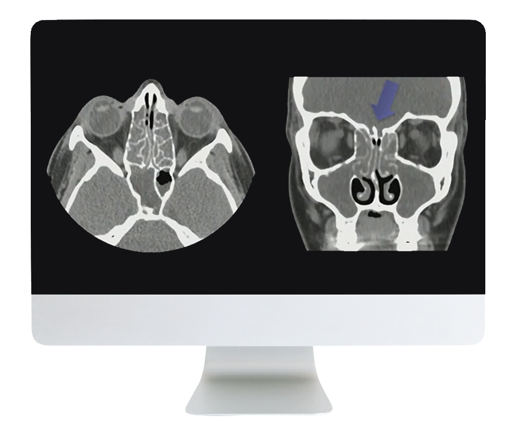 Cranial Nerve Imaging: From the Least to the Last