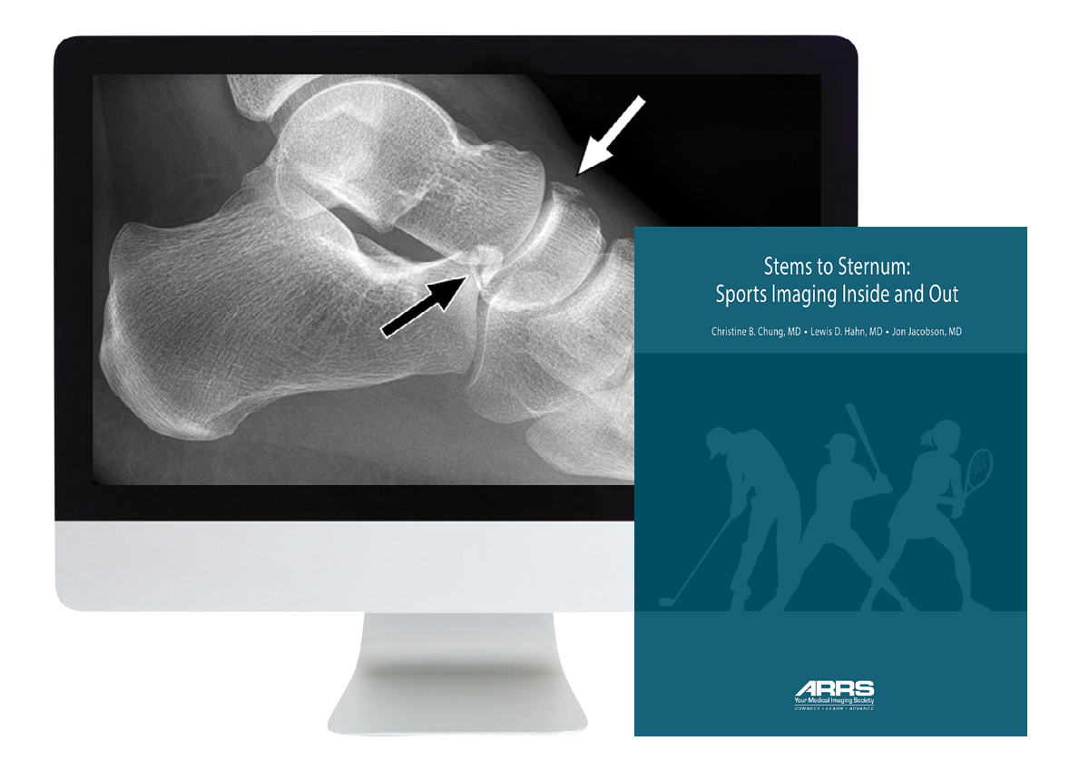 Stems to Sternum: Sports Imaging Inside and Out Online Course