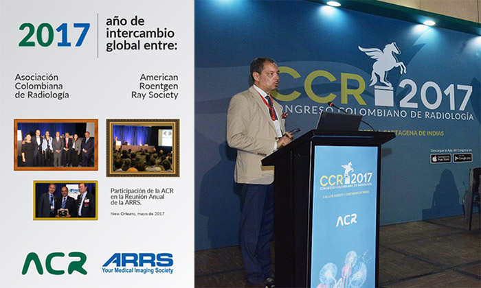 ACR Global Exchange